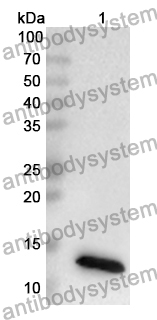 Anti-HPV52 E7/Protein E7 Polyclonal Antibody